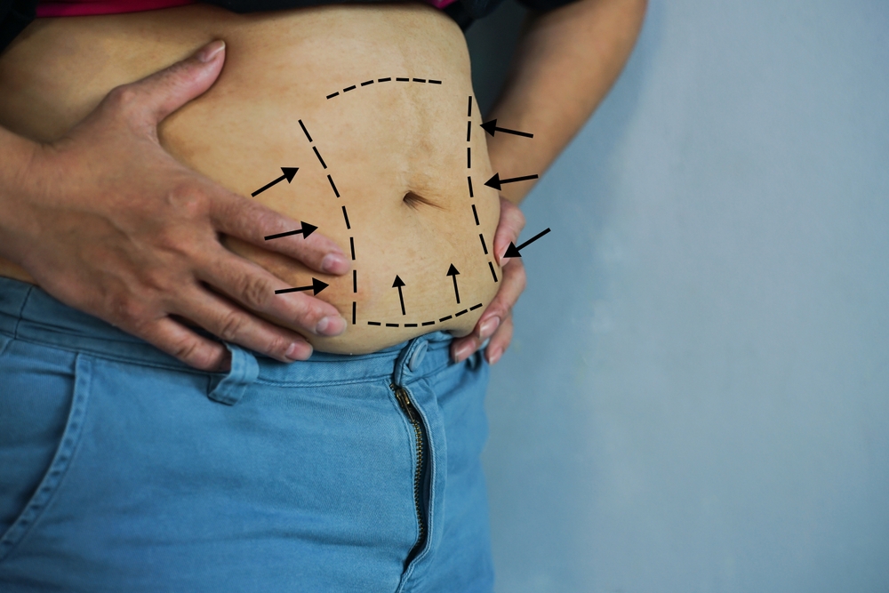 critical role of hormones in weight loss
